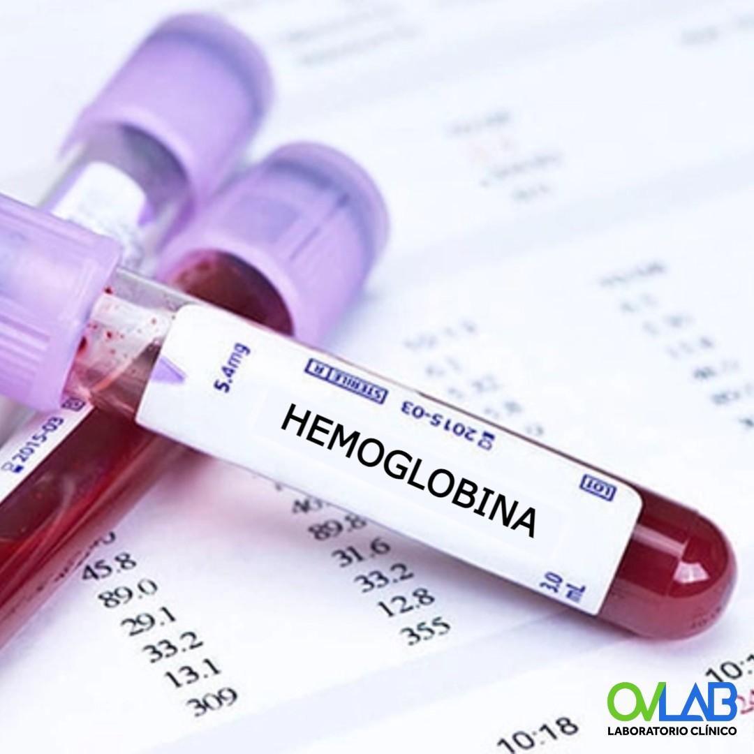 Hemoglobina Hematocrito Hb Hto Ovlab O V Laboratorios
